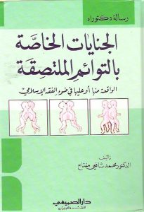 الجنايات الخاصة بالتوائم الملتصقة